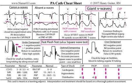 Basic Dysrhythmia Practice Test 的图像结果