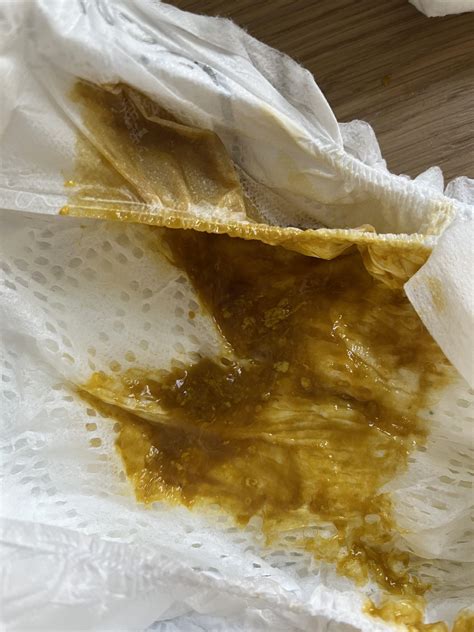 Breastfed Baby Poop Acidic at Alyssa Corrie blog