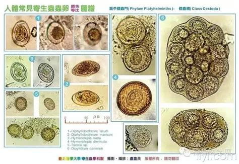 台北医学大学精美寄生虫虫卵图（超清晰，收藏吧）
