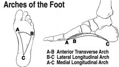 Foot Arches and Orthotic Solutions: Managing flat foot with Custom Insoles
