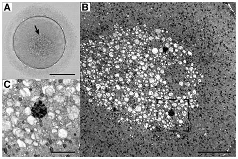 The ultrastructural nature of human oocytes’ cytoplasmic abnormalities and the role of ...