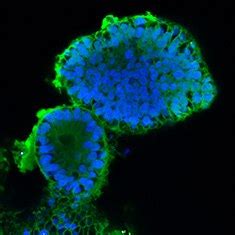 In Vitro Differentiation of Human iPS Cells Into Colon Organoids in ...