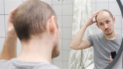 Does Adderall Cause Hair Loss - New Chapter Recovery