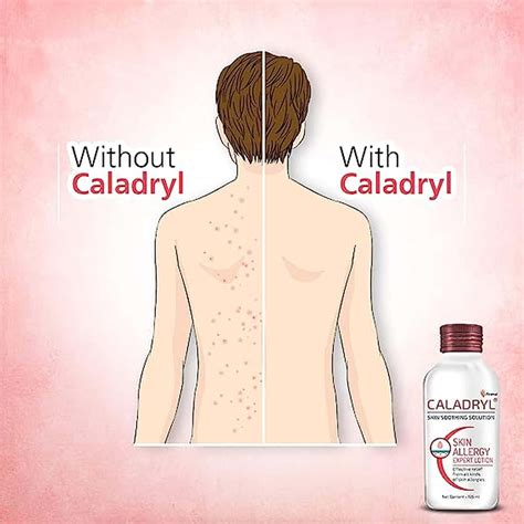 Buy CALADRYL SKIN ALLERGY EXPERT LOTION PACK OF 3 (3 X 125 ML), WHITE ...