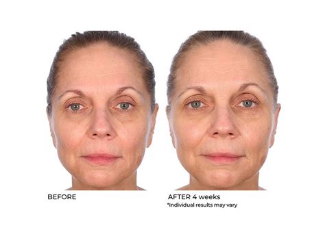 NassifMD® Radiance Brightening Vitamin C Booster Serum | LovelySkin