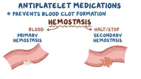 Antiplatelet medications: Video, Causes, & Meaning | Osmosis