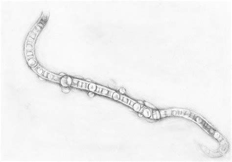 Image result for Eye Floaters Under Microscope