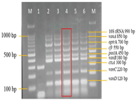 Diagnostics | Special Issue : Molecular Diagnostics of Infectious Diseases