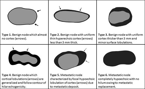 Benign Or Malignant Lymph Nodes Ultrasound Introduction Of The WHO