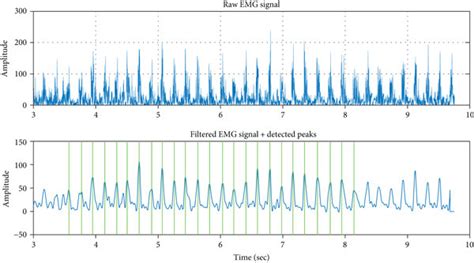 Image result for Multiple Extraction