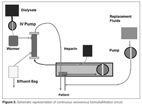 CRRT Recirculation 的图像结果