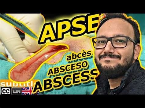 Image result for Painful Giant Abscess Exploding