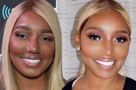 NeNe Leakes Opens Up About What Plastic Surgery She’d Still Get And What Procedures She Never ...