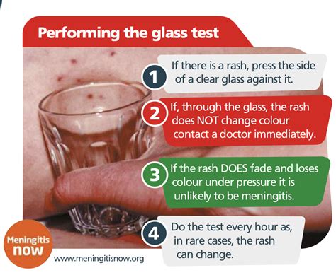 Sepsis: spotting the signs :: West Yorkshire Healthier Together