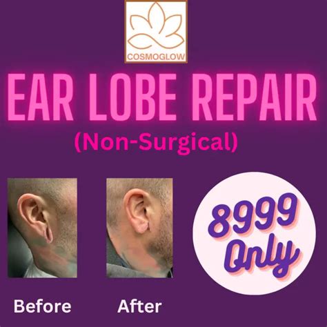 Ear Lobe Repair – COSMOGLOW Skin Hair Laser Clinic