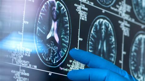 These six exercise habits could be increasing your risk of injury, according to a sports medicine ex Background