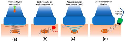 Quantitative Ultrasound Techniques Used for Peripheral Nerve Assessment