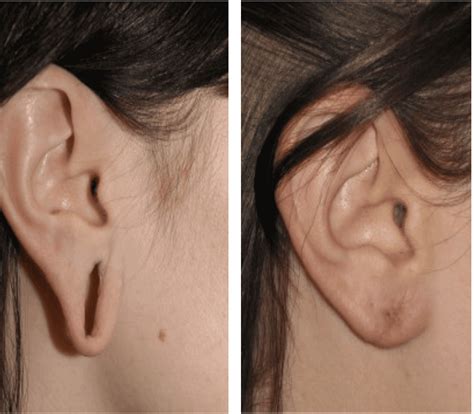 Dermalive Skin Clinic