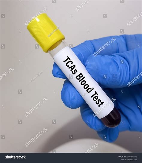 Blood Sample Tricyclic Antidepressant Tca Drug Stock Photo 2495271065 ...