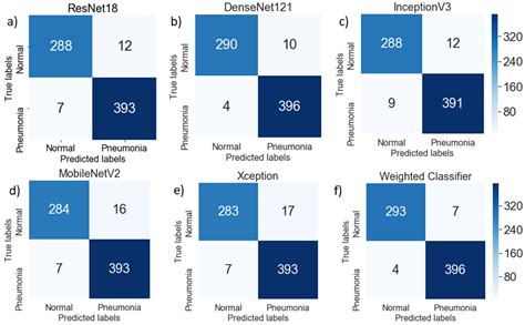 Efficient Pneumonia Detection in Chest Xray Images Using Deep Transfer ...