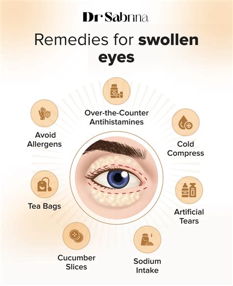 How To Alleviate Swollen Eyes