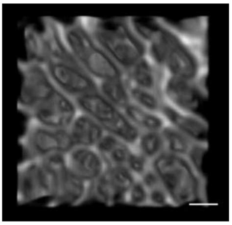 Ontogenetic Patterning of Human Subchondral Bone Microarchitecture in ...