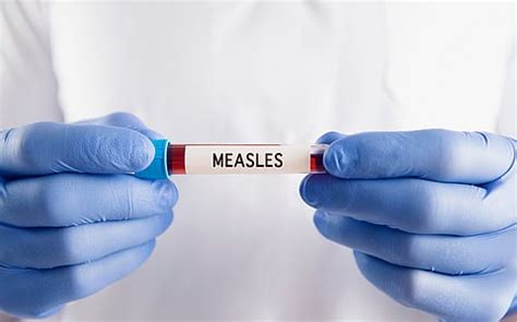 Health Updates | Latest news on health-related issues, Healthcare news ...