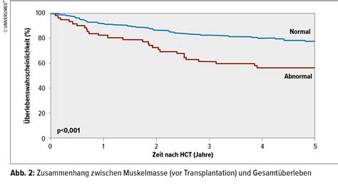 Neue Trends in der Stammzelltransplantation – Update vom ASH 2018 ...