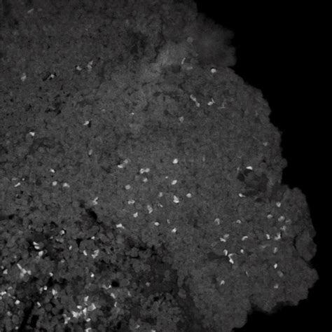 Image result for Deep Tissue Pi