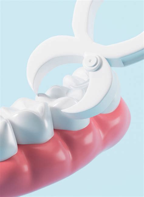 Post Tooth Extraction Healing 的图像结果