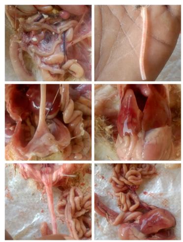 Pathophysiology, Clinical Symptoms, and Nutritional Management of ...