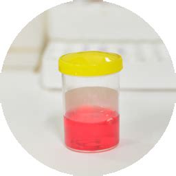 Kidney Stones Treatment - Endoscopic kidney stones removal surgery in ...