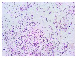 Biotechnological Potential of Oil-Tolerant Strains for Possible Use in ...