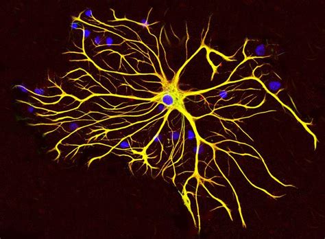 Image result for Astrocyte
