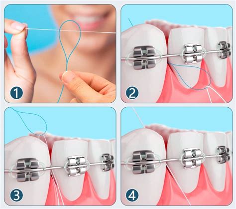 Image result for Using a Floss Threader