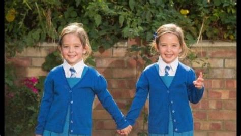 Formerly conjoined twins start kindergarten | FOX 5 Atlanta
