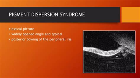 ultrasound biomicroscopy | PPTX