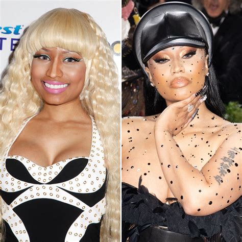 Nicki Minaj Before Surgery