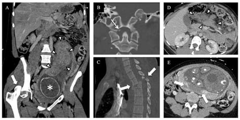 Initial Imaging of Pregnant Patients in the Trauma Bay—Discussion and ...