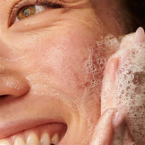 How to Get Rid of Bacne ft Tea Tree Body Wash