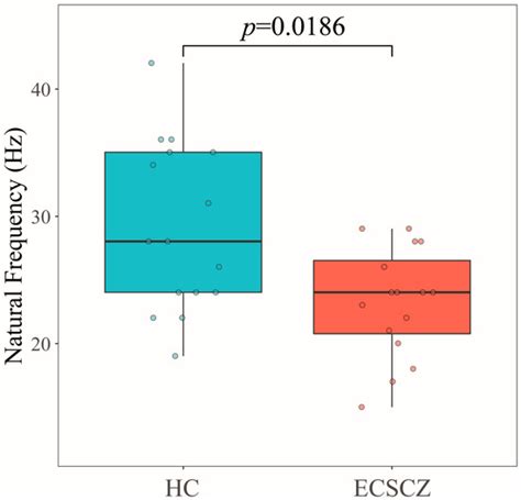 Natural Oscillatory Frequency Slowing in the Premotor Cortex of Early ...