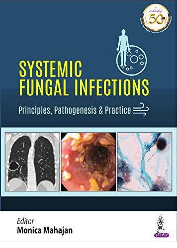 Systemic Fungal Infections eBook : Mahajan, Monika: Amazon.in: Kindle Store