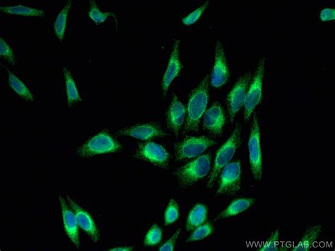 PDIA6 antibody (66669-1-Ig) | Proteintech