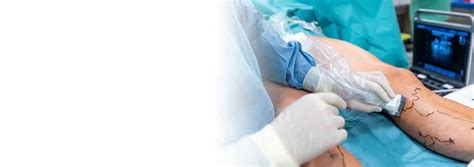 Varicose Veins Treatment - Healic Clinic