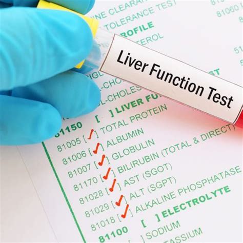 Image result for Liver Function Labs