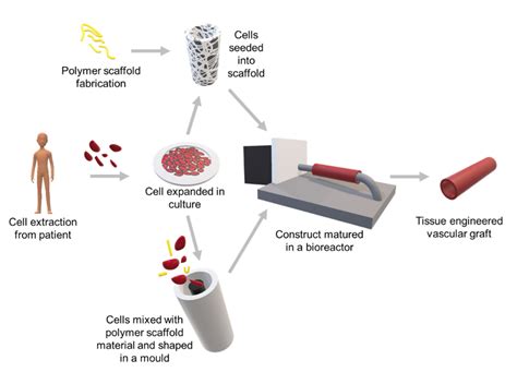 Bioresorbable Polymeric Scaffold in Cardiovascular Applications