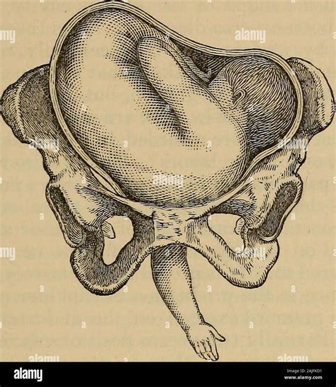 A treatise on the science and practice of midwifery . the spine of the ...