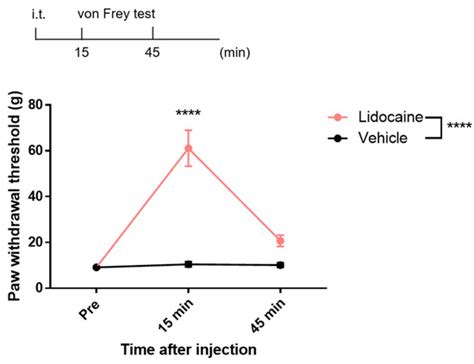 Development of a Novel Method of Spinal Electrophysiological Assessment ...