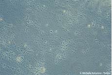 tappeto di emazie bacteria fungi tappeto di emazie bacteria fungi