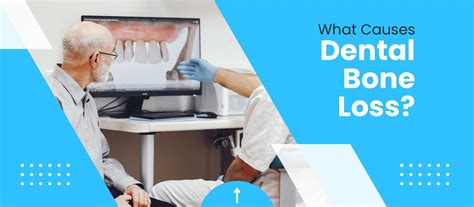 What_Causes_Dental_Bone_Loss | Dentist Contract Attorney